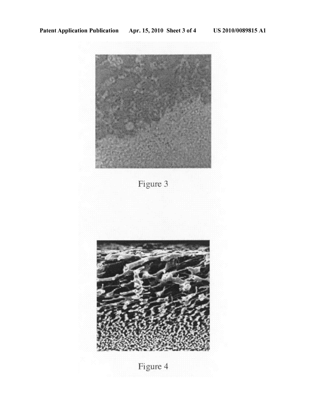 Rapid and efficient filtering whole blood in capillary flow device - diagram, schematic, and image 04