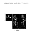 IMPLEMENTATION OF COLORED WAVELENGTH SHIFTERS IN PHOSWICH DETECTORS diagram and image