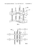 Ladder Display System diagram and image