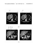 Combined Segmentation And Registration Framework For Parametric Shapes diagram and image