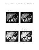 Combined Segmentation And Registration Framework For Parametric Shapes diagram and image