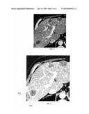 Combined Segmentation And Registration Framework For Parametric Shapes diagram and image