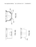 Total Internal Reflection Lens and Mechanical Retention and Locating Device diagram and image