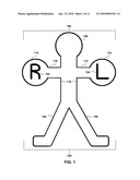 ANATOMICAL MARKER FOR X-RAY ORIENTATION diagram and image