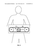 ANATOMICAL MARKER FOR X-RAY ORIENTATION diagram and image