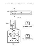 ANATOMICAL MARKER FOR X-RAY ORIENTATION diagram and image