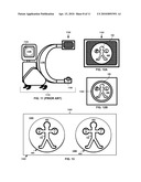 ANATOMICAL MARKER FOR X-RAY ORIENTATION diagram and image