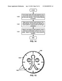 ANATOMICAL MARKER FOR X-RAY ORIENTATION diagram and image