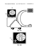 ANATOMICAL MARKER FOR X-RAY ORIENTATION diagram and image