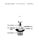 Replenishment and Enrichment of Ocular Surface Lubrication diagram and image