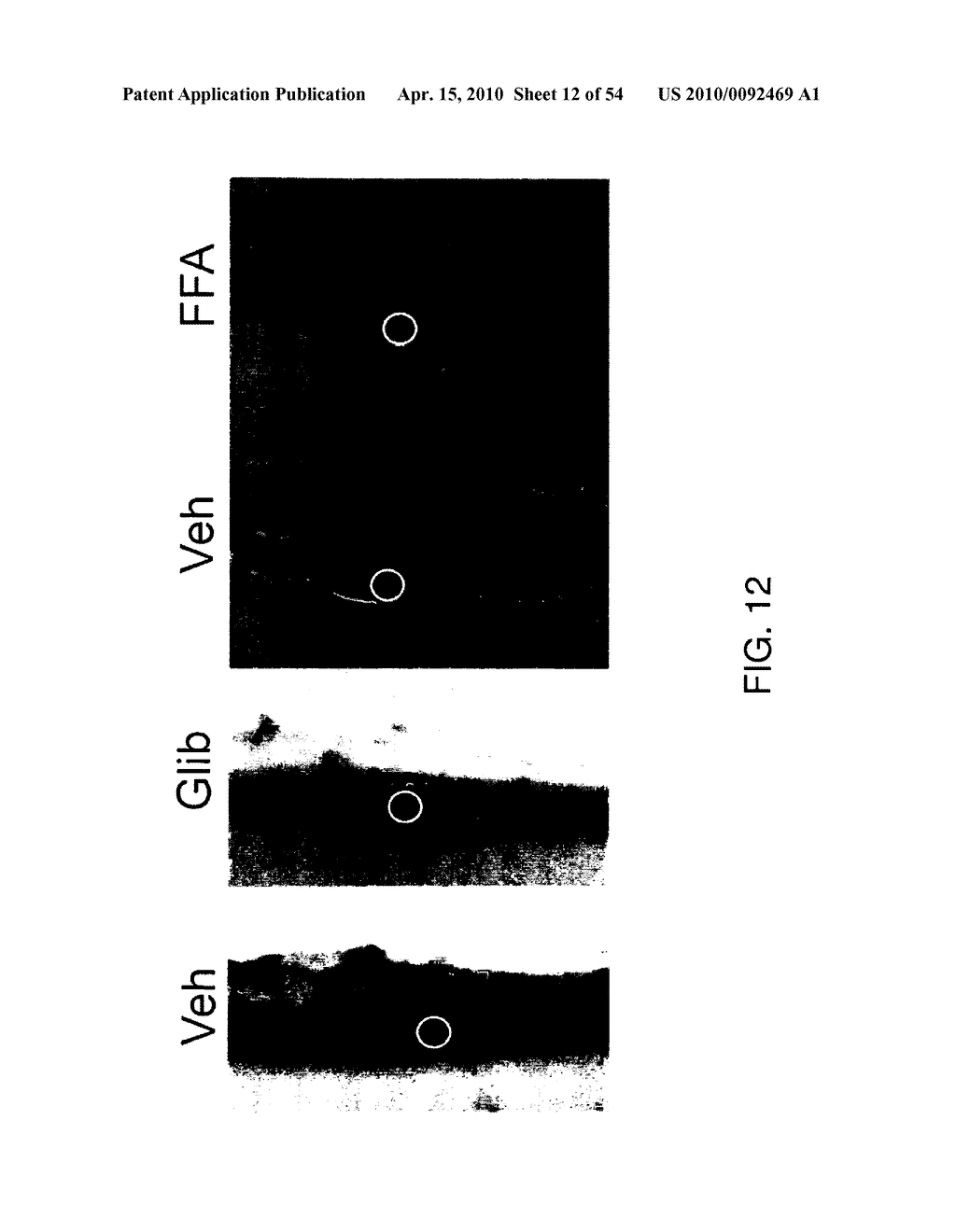 ANTAGONISTS OF A NON-SELECTIVE CATION CHANNEL IN NEURAL CELLS - diagram, schematic, and image 13