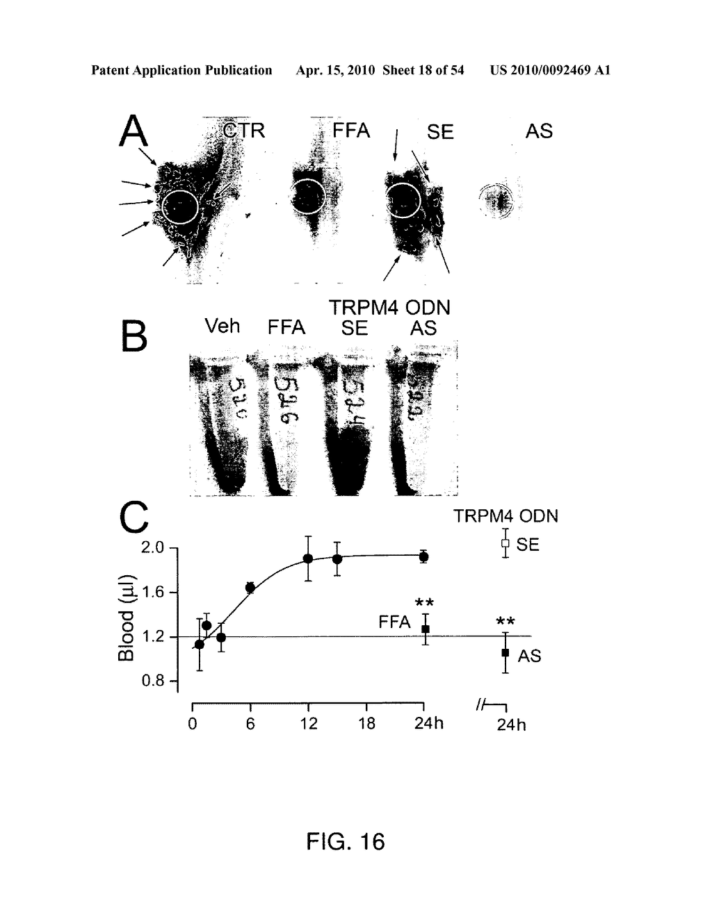 ANTAGONISTS OF A NON-SELECTIVE CATION CHANNEL IN NEURAL CELLS - diagram, schematic, and image 19