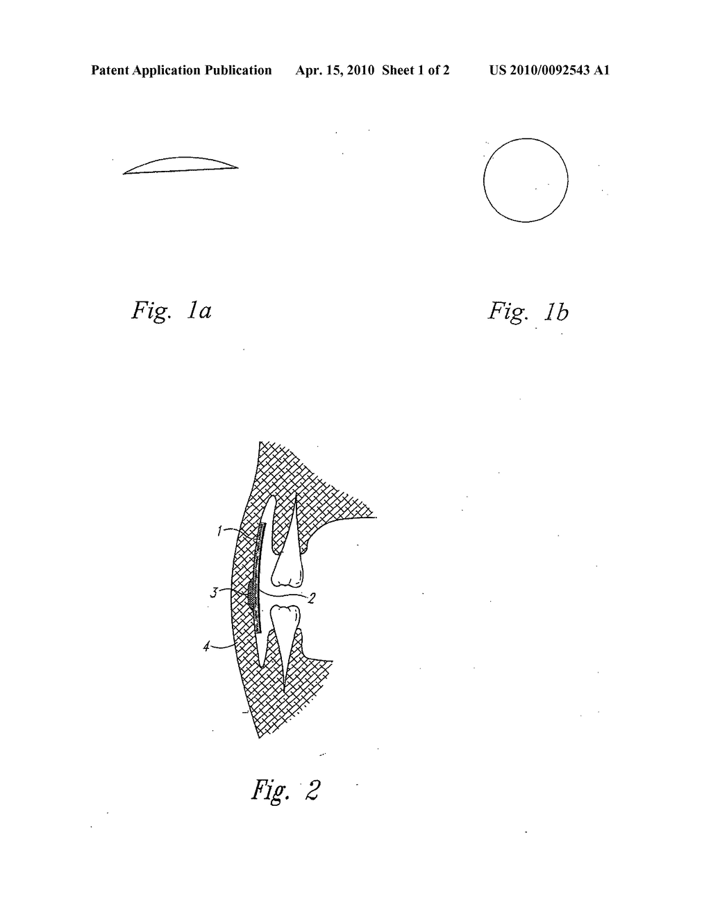 Dimpled adhering troche for use on teeth or orthodontic braces - diagram, schematic, and image 02