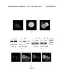 MGMT INHIBITOR COMBINATION FOR THE TREATMENT OF NEOPLASTIC DISORDERS diagram and image