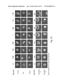 MGMT INHIBITOR COMBINATION FOR THE TREATMENT OF NEOPLASTIC DISORDERS diagram and image