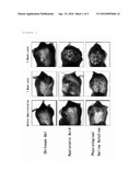 ANTI-TUMOR COMPOSITION COMPRISING TISSUE-ACCUMULATING CHITOSAN GEL diagram and image