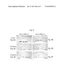 STEROIDAL COMPOUNDS AS MELANOGENESIS MODIFIERS AND USES THEREOF diagram and image