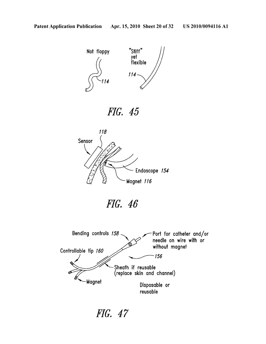 PERCUTANEOUS MAGNETIC GASTROSTOMY - diagram, schematic, and image 21