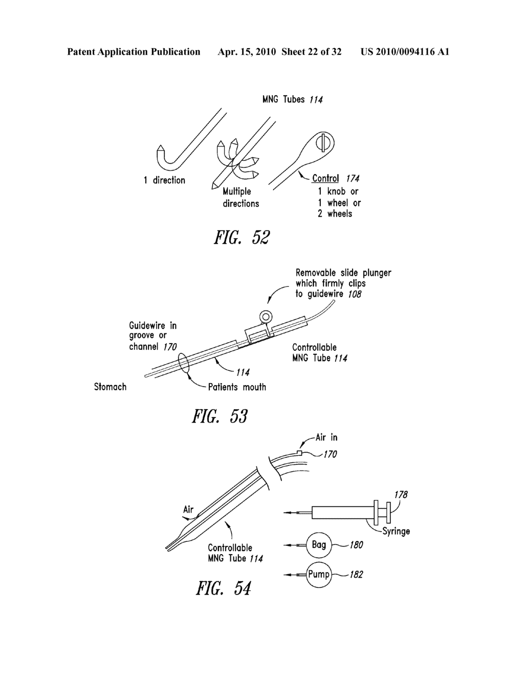 PERCUTANEOUS MAGNETIC GASTROSTOMY - diagram, schematic, and image 23