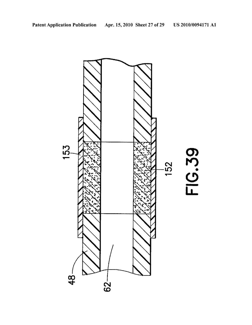 BLOOD COLLECTION SET WITH VENTING MECHANISM - diagram, schematic, and image 28