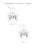 METHOD FOR ROTATING A VERTEBRA OR VERTEBRAE diagram and image