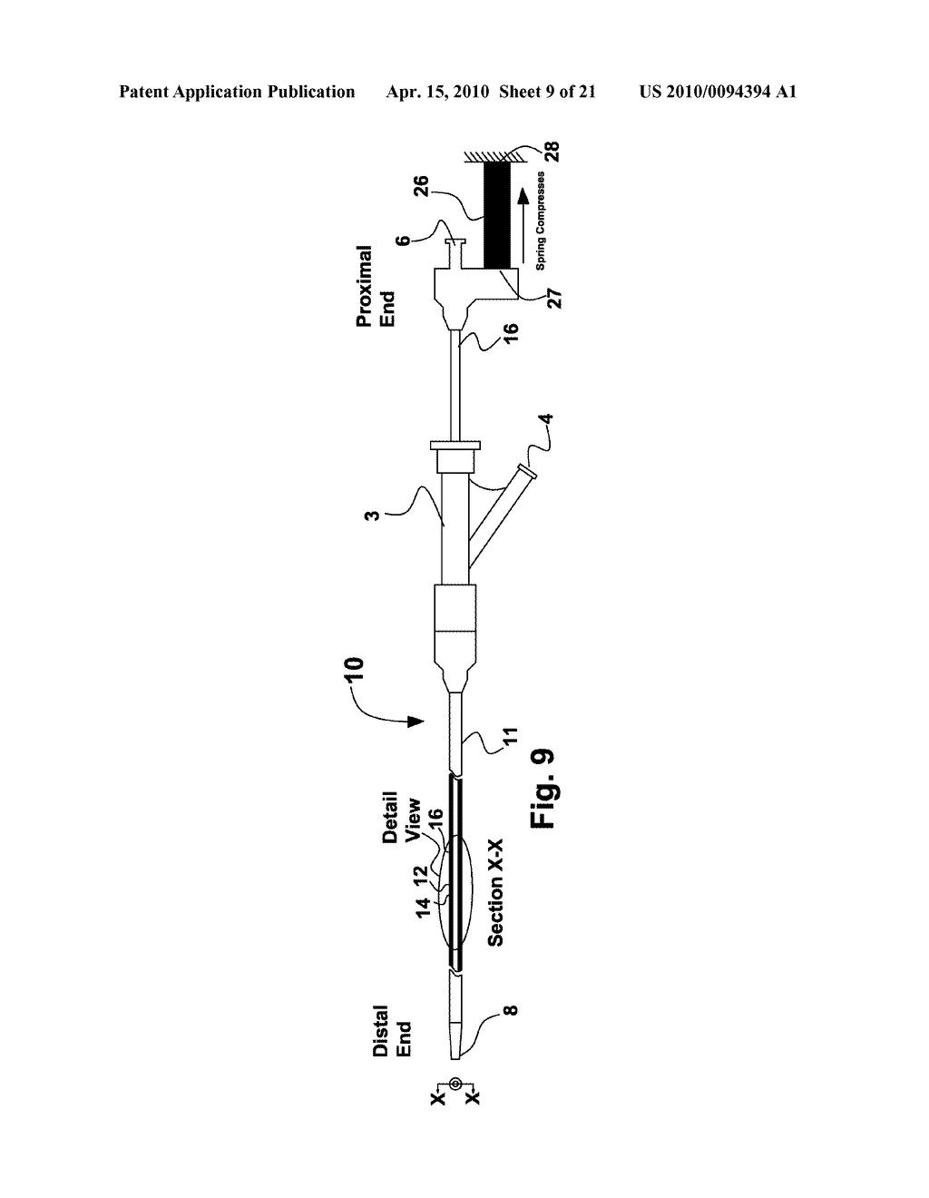 RECONSTRAINABLE STENT DELIVERY SYSTEM - diagram, schematic, and image 10