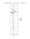 Method and Apparatus for Protecting Power Systems from Extraordinary Electromagnetic Pulses diagram and image