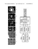 MALIGNANCY DIAGNOSIS USING CONTENT - BASED IMAGE RETREIVAL OF TISSUE HISTOPATHOLOGY diagram and image