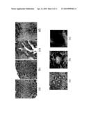 MALIGNANCY DIAGNOSIS USING CONTENT - BASED IMAGE RETREIVAL OF TISSUE HISTOPATHOLOGY diagram and image