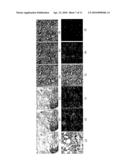 MALIGNANCY DIAGNOSIS USING CONTENT - BASED IMAGE RETREIVAL OF TISSUE HISTOPATHOLOGY diagram and image