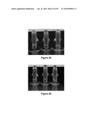 FORMULATION AND METHOD FOR THE TREATMENT OF FUNGAL NAIL INFECTIONS diagram and image