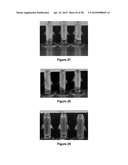 FORMULATION AND METHOD FOR THE TREATMENT OF FUNGAL NAIL INFECTIONS diagram and image