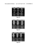 FORMULATION AND METHOD FOR THE TREATMENT OF FUNGAL NAIL INFECTIONS diagram and image