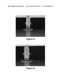 FORMULATION AND METHOD FOR THE TREATMENT OF FUNGAL NAIL INFECTIONS diagram and image