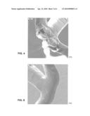 MOUNTING ASSEMBLY FOR A STENT AND A METHOD OF USING THE SAME TO COAT A STENT diagram and image