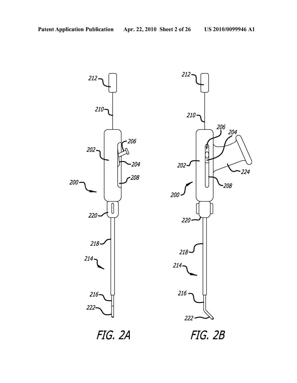 METHODS AND APPARATUS FOR TREATING DISORDERS OF THE EAR NOSE AND THROAT - diagram, schematic, and image 03