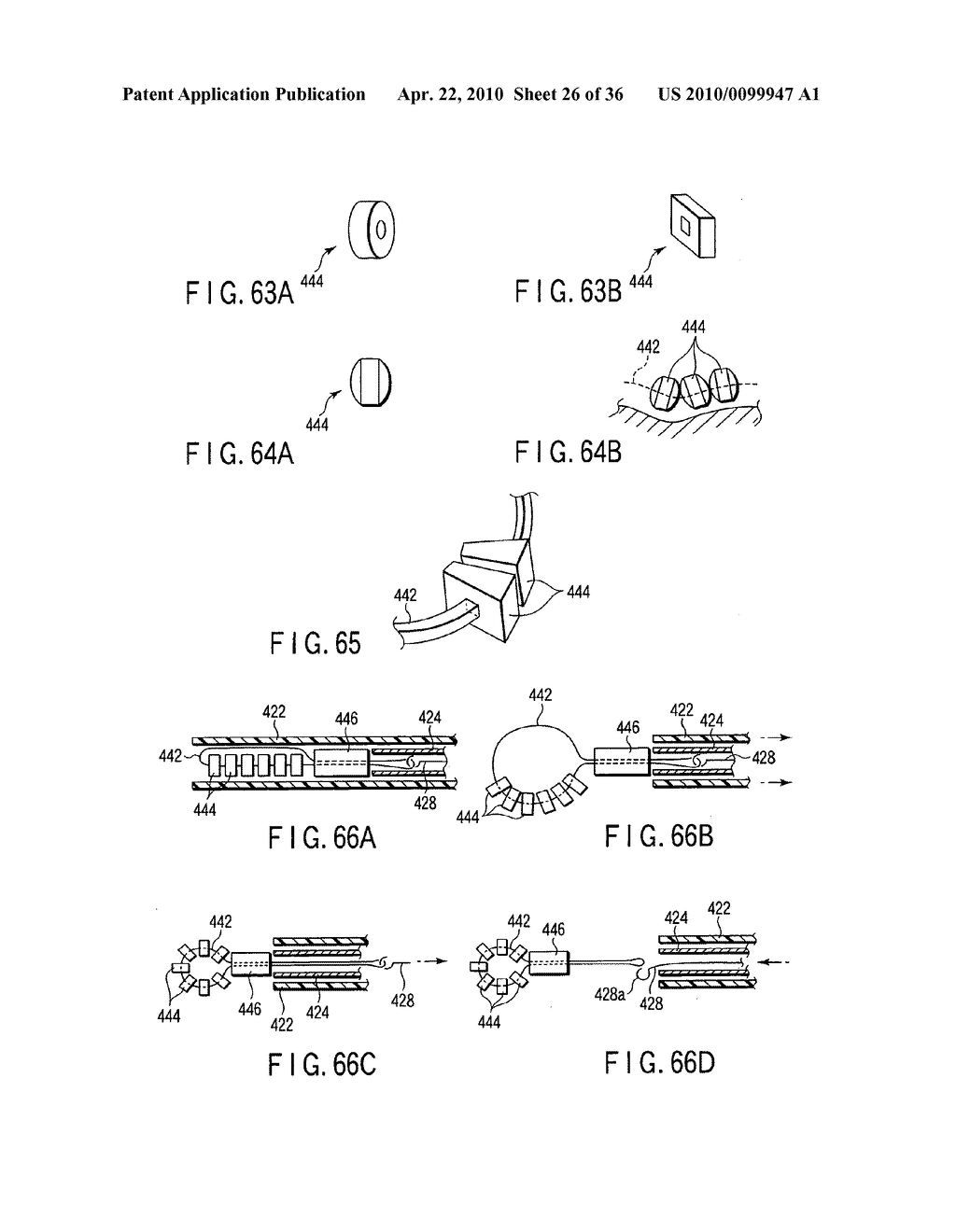 FISTULECTOMY METHOD OF FORMING A FISTULA BETWEEN A FIRST DUCT AND A SECOND DUCT - diagram, schematic, and image 27