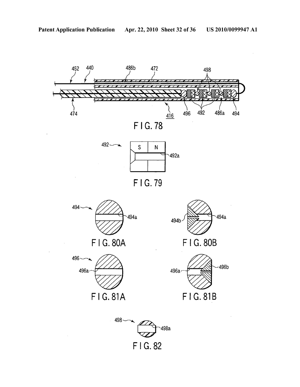 FISTULECTOMY METHOD OF FORMING A FISTULA BETWEEN A FIRST DUCT AND A SECOND DUCT - diagram, schematic, and image 33