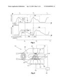 METHOD FOR DETERMINING MICROVASCULAR LESIONS diagram and image