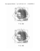 ULTRASONIC DIAGNOSTIC DEVICE, ULTRASONIC IMAGE PROCESSING APPARATUS, ULTRASONIC IMAGE ACQUIRING METHOD AND ULTRASONIC DIAGNOSIS DISPLAY METHOD diagram and image