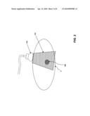 Radiotherapy Treatment Monitoring Using Ultrasound diagram and image