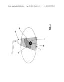 Radiotherapy Treatment Monitoring Using Ultrasound diagram and image