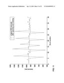 METHOD AND APPARATUS FOR ECTOPIC BEAT DETECTION diagram and image