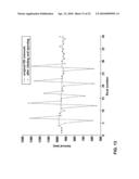 METHOD AND APPARATUS FOR ECTOPIC BEAT DETECTION diagram and image