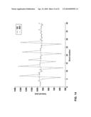 METHOD AND APPARATUS FOR ECTOPIC BEAT DETECTION diagram and image