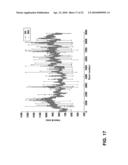 METHOD AND APPARATUS FOR ECTOPIC BEAT DETECTION diagram and image