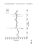 METHOD AND APPARATUS FOR ECTOPIC BEAT DETECTION diagram and image