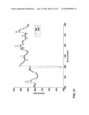 METHOD AND APPARATUS FOR ECTOPIC BEAT DETECTION diagram and image