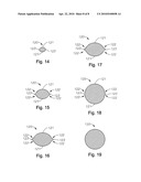 Micro-Vitreoretinal Trocar Blade diagram and image