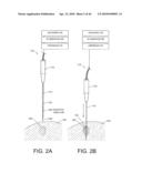 TISSUE ABLATION SYSTEMS diagram and image